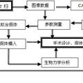 个性化定制髋关节假体的三维CAD设计方案及虚拟移植的研究